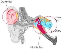 what is mixed hearing loss? 